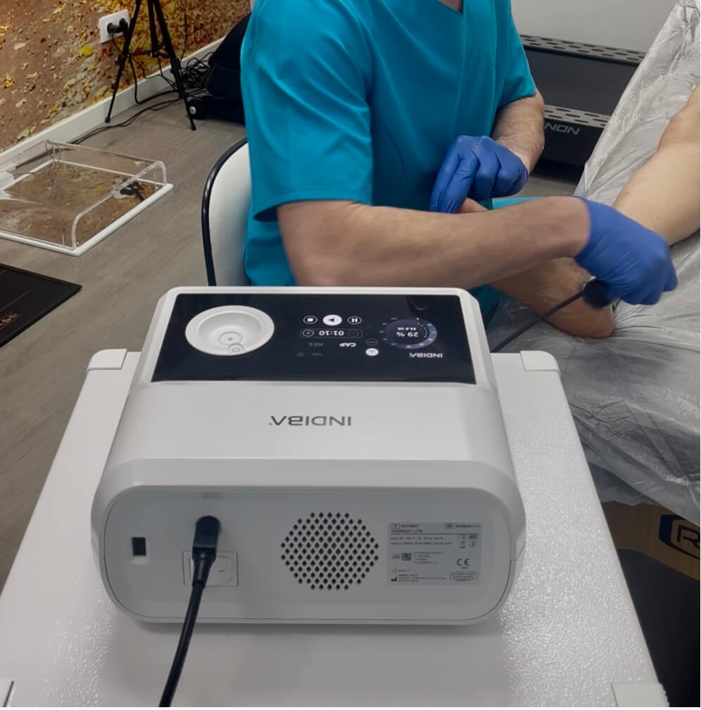 rehabilitacion-pie-tobillo-madrid-2