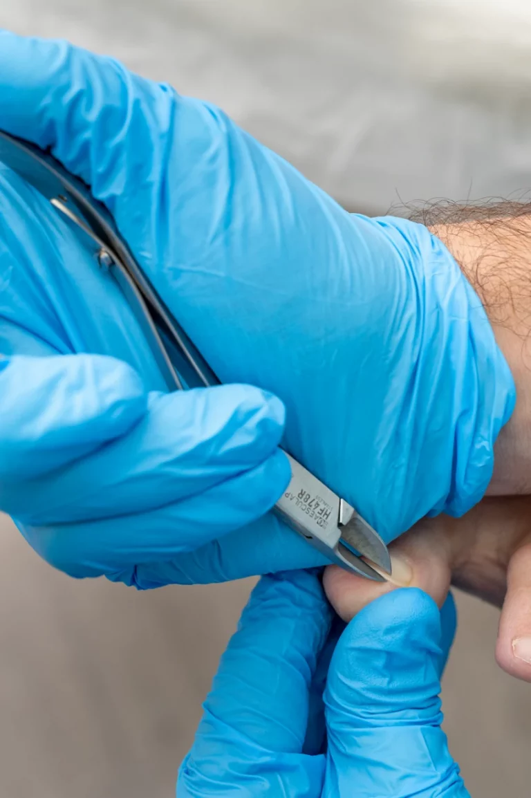 podologo-arguelle-tratamientos-1