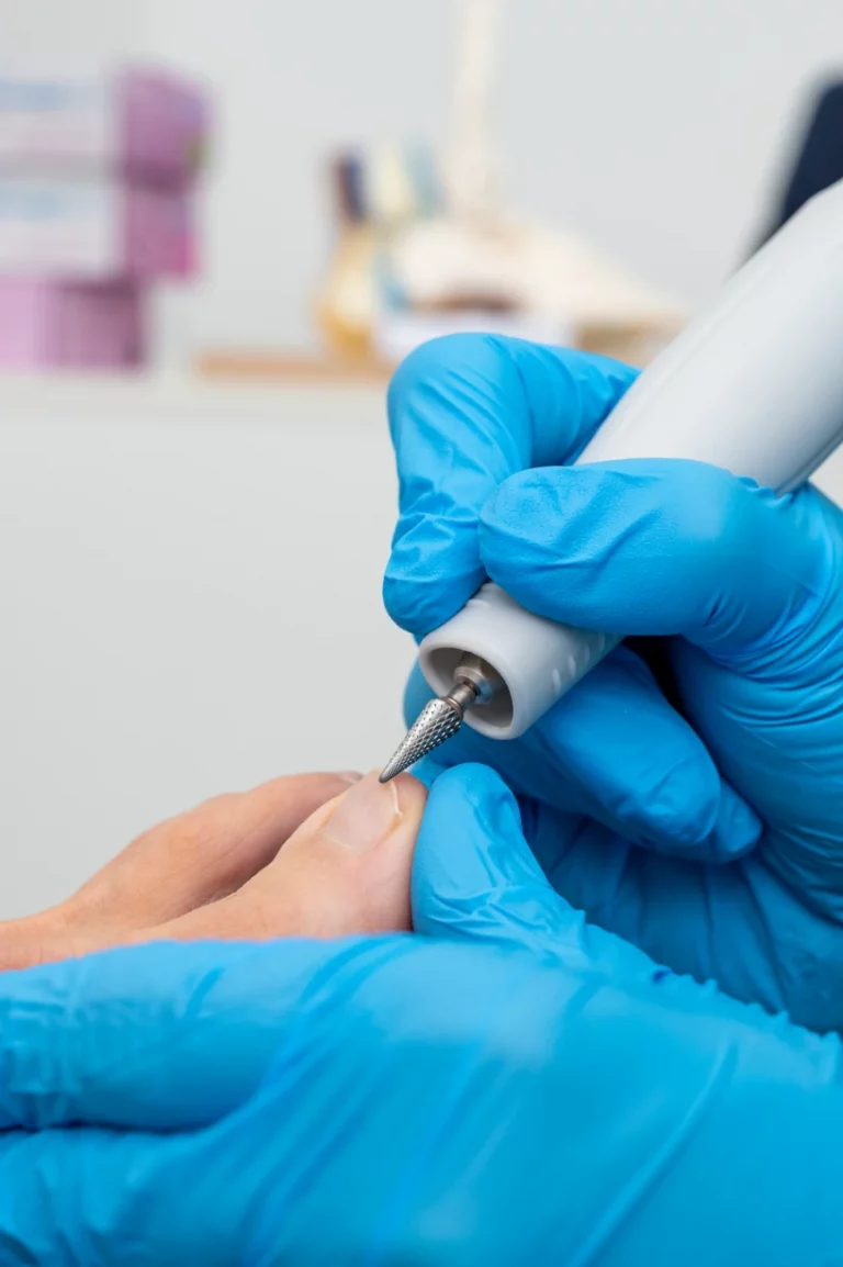 podologo-arguelle-tratamientos-3